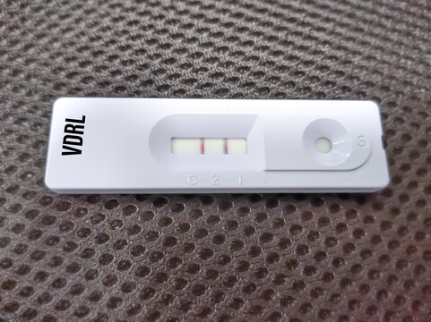 Rapid test cassette for Syphilis test(VDRL) ,The result showed Positive, Non-specific Test