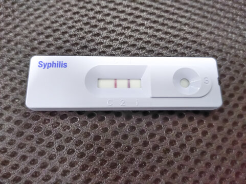 Rapid test cassette for Syphilis test(TPHA) ,The result showed Positive
