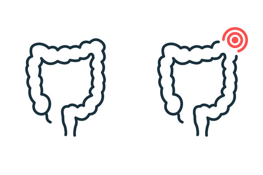 Healthy and Sick Colon Line Icon. Diseased Bowel Outline Icon. Health, Illness Large Intestine Pictogram. Diarrhea, Dysbiosis, Stomachache Concept. Editable Stroke. Isolated Vector Illustration