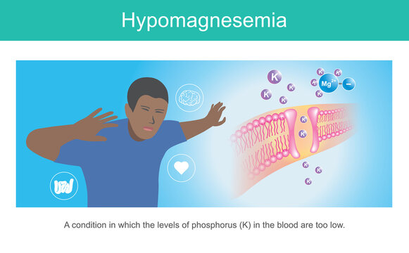 HYPOMAGNESEMIA. Illustration for showing symptoms&nbsp;a man condition in which the levels of phosphorus in blood are too low..
