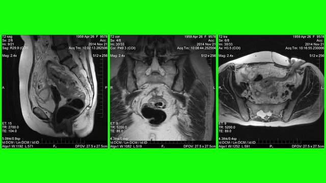 MRI , Magnetic resonance images of human body parts, green background for transparency.
