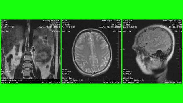 MRI , Magnetic resonance images of human body parts, green background for transparency.