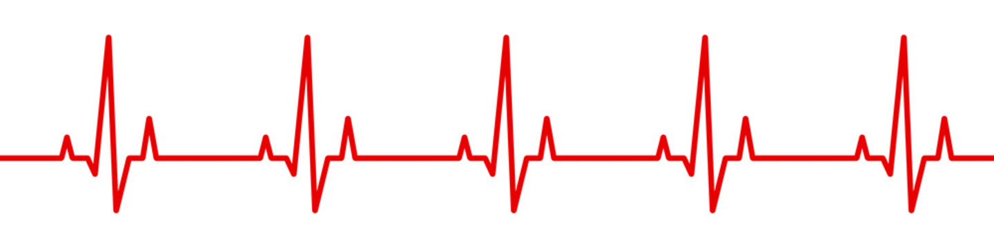 Heartbeat line