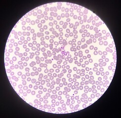 Blood cell find with microscope.