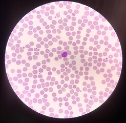 Blood cell find with microscope.