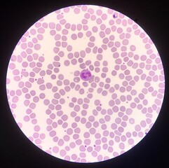 Blood cell find with microscope.