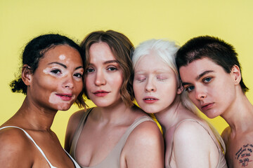 Obraz premium Group of multiethnic women with different kind of skin posing together in studio. Concept about body positivity and self acceptance