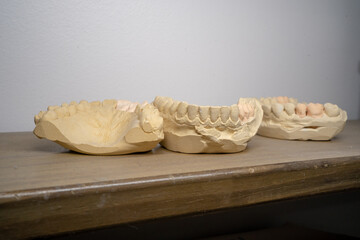 plaster teeth molds. used in making dental prostheses. for dental implant © Isaac