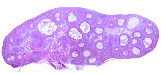 Ovary. Follicles