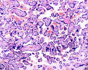 Human term placenta