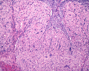 Corpus luteum. Granulosa-lutein and theca-lutein cells