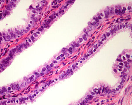 Fallopian tube mucosa fold
