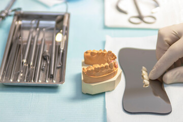 Anterior denture prosthesis for implant placement.