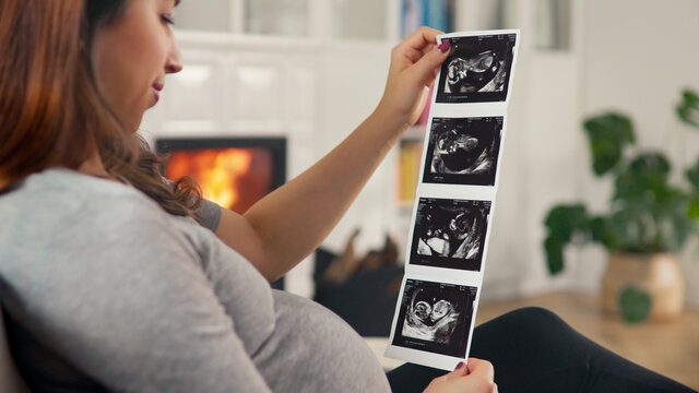 Beautiful pregnant woman with brown hair stitting in front of cosy fireplace look at ultrasound pictures