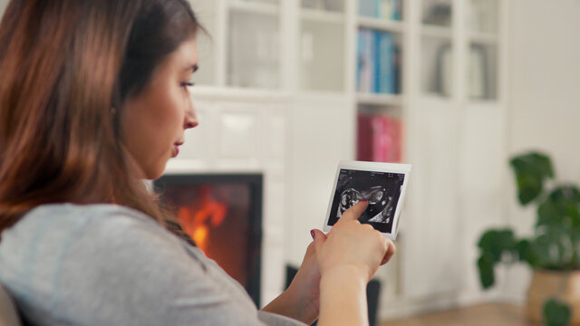 Beautiful pregnant woman with brown hair stitting in front of cosy fireplace look at ultrasound pictures