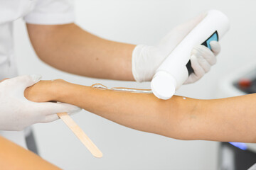 Laser hair removal master applies a cooling gel to the skin of a woman's hand