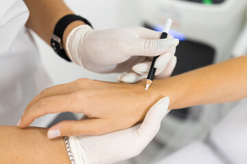 Epilation master paints with a protective pencil moles on the woman hand before laser hair removal