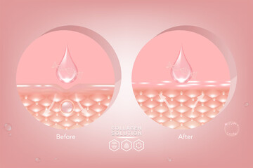 Hyaluronic acid before and after skin solutions ad, pink collagen serum drops with cosmetic advertising background ready to use, illustration vector.