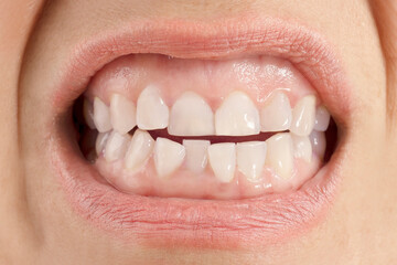 Fototapeta premium close up of a mouth with a smile