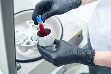 Female technician hands holding test tube with blood