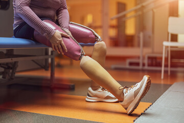 Fototapeta na wymiar Close up of a woman with prosthetic legs 