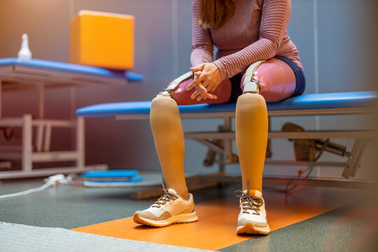 Close up of a woman with prosthetic legs 
