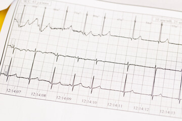 Close up of ECG, electrocardiogram. The work of a healthy heart on paper.