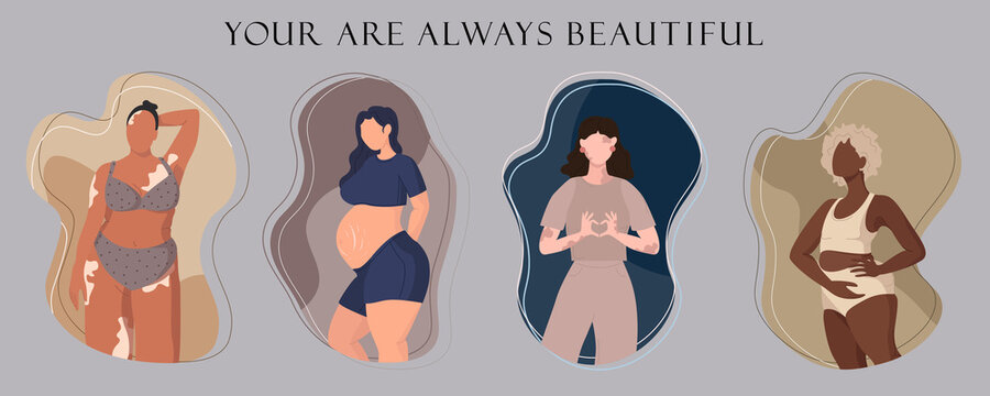 Collection of body positive diverse women. Set of girls with black skin or vitiligo in lingerie and pregnant. Your are beautiful