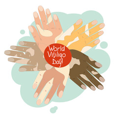 Hands of light and dark skin with depigmentation of vitiligo