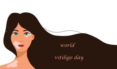 Vector flat concept of world vitiligo day. Girl with vitiligo.