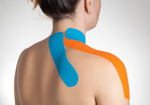 Fixation of muscles and ligaments on the girl's shoulder with blue and orange kinesiological tape, close-up. Taping in sports