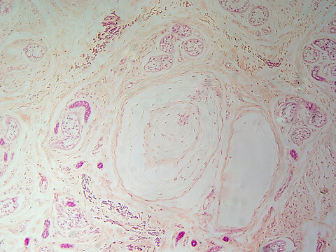 Microscope histology image of Meissner's corpuscle of the dermis (100x)