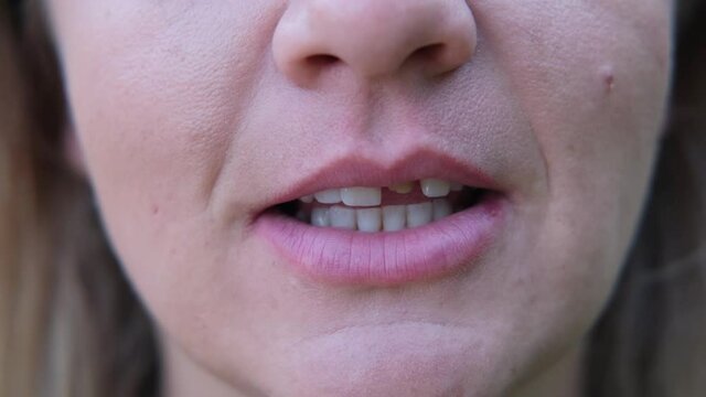 Woman's smile with a bad tooth. Teeth before treatment. Close-up.