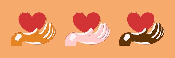 Hands of a man with vitiligo skin disease. Set with different skin colors. Support, love and help. World vitiligo day. Flat vector illustration isolated