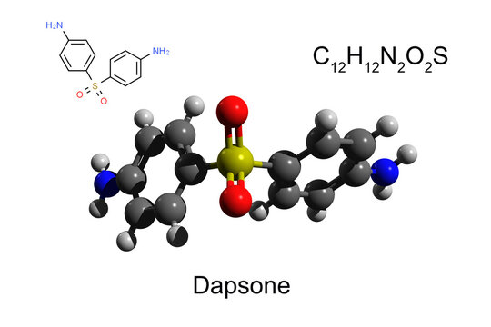 Chemical formula, structural formula and 3D ball-and-stick model of an antimicrobial dapsone, white background