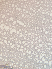 photo of blood cells under microscope