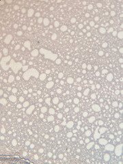 photo of blood cells under microscope