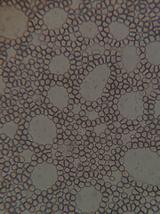 photo of blood cells under microscope