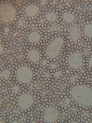 photo of blood cells under microscope