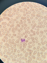 photo of blood cells under microscope