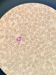 photo of blood cells under microscope