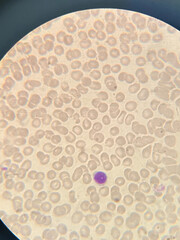 photo of blood cells under microscope
