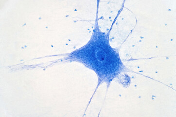 Neurons cells from the brain under the microscope view.