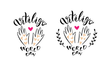 Set of two Vitiligo World Day lettering compositions with hands. Vector isolated illustration. 