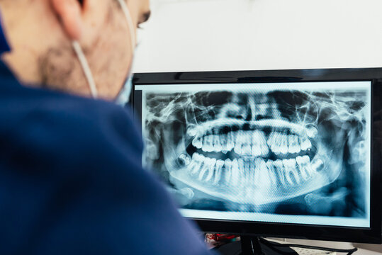 Male medical dentist examining a panoramic x-ray on a computer screen while working in a dental clinic. Health care and medicine concept.