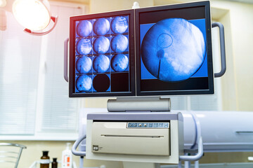 Medical monitor in surgery operating room. Professional monitor against the hospital room.