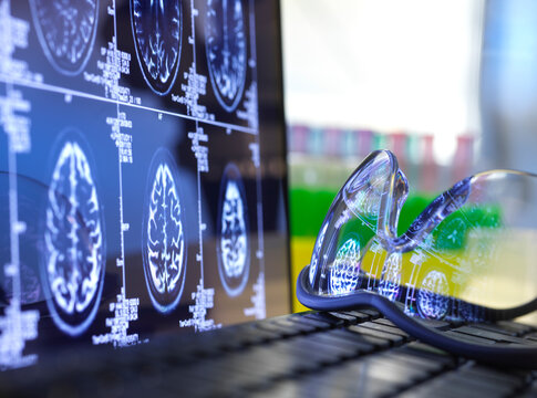 Brain scan results reflecting in protective glasses lying on laptop keyboard