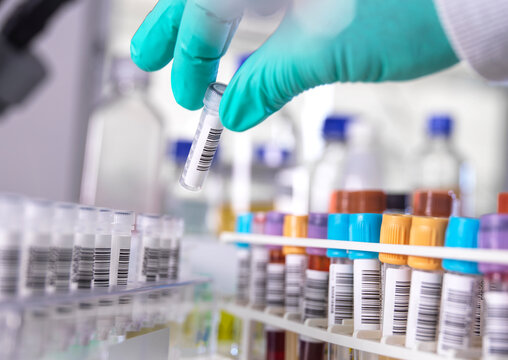 Hand of scientist wearing protective glove picking up sample in laboratory