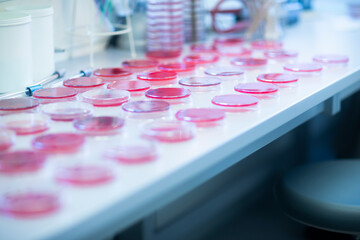 Petri dishes with growth medium in lab