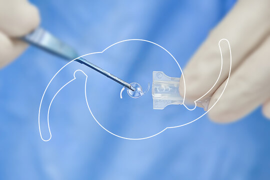 iol intraocular lens cataract ophthalmology